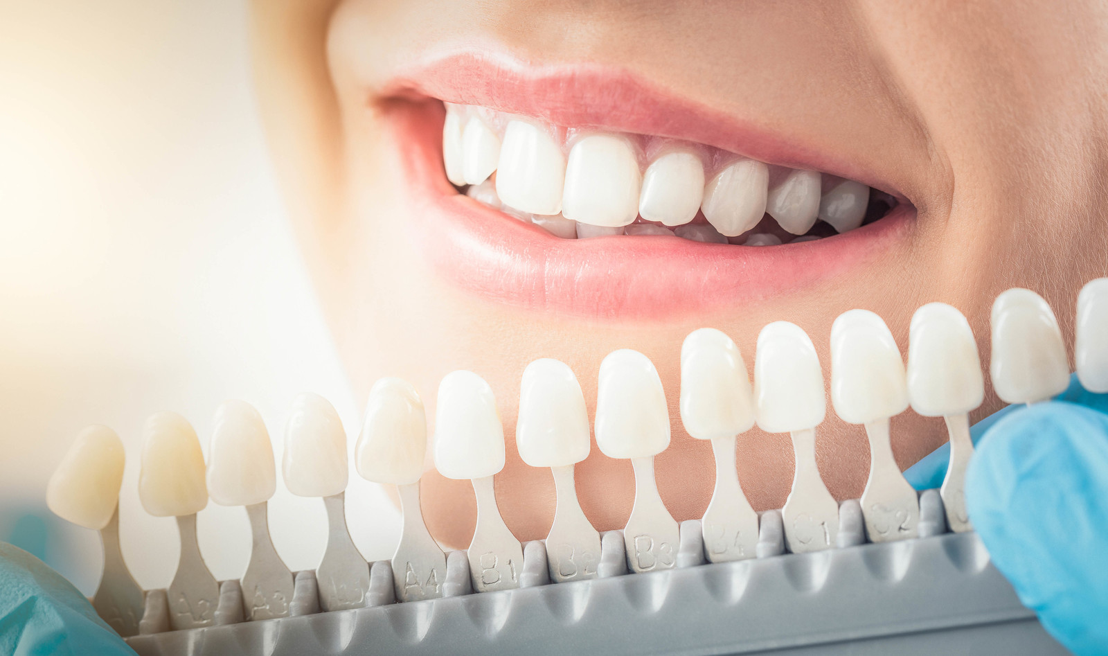 cosmetic teeth whitening industry