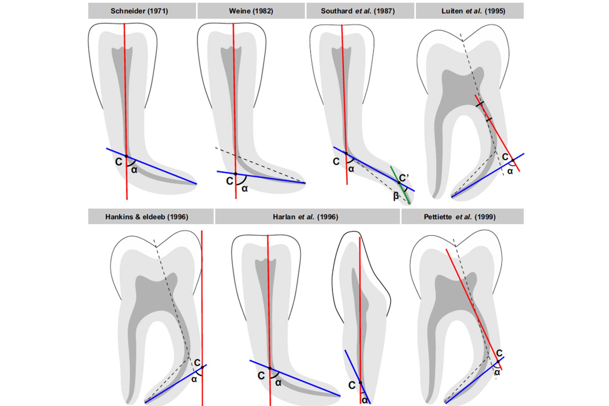 the-endo-expert-managing-curved-canals-dentistry-online