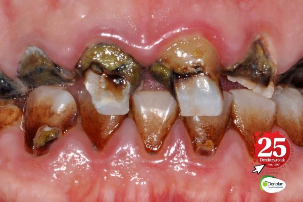 The history of oral health: a 25-year perspective