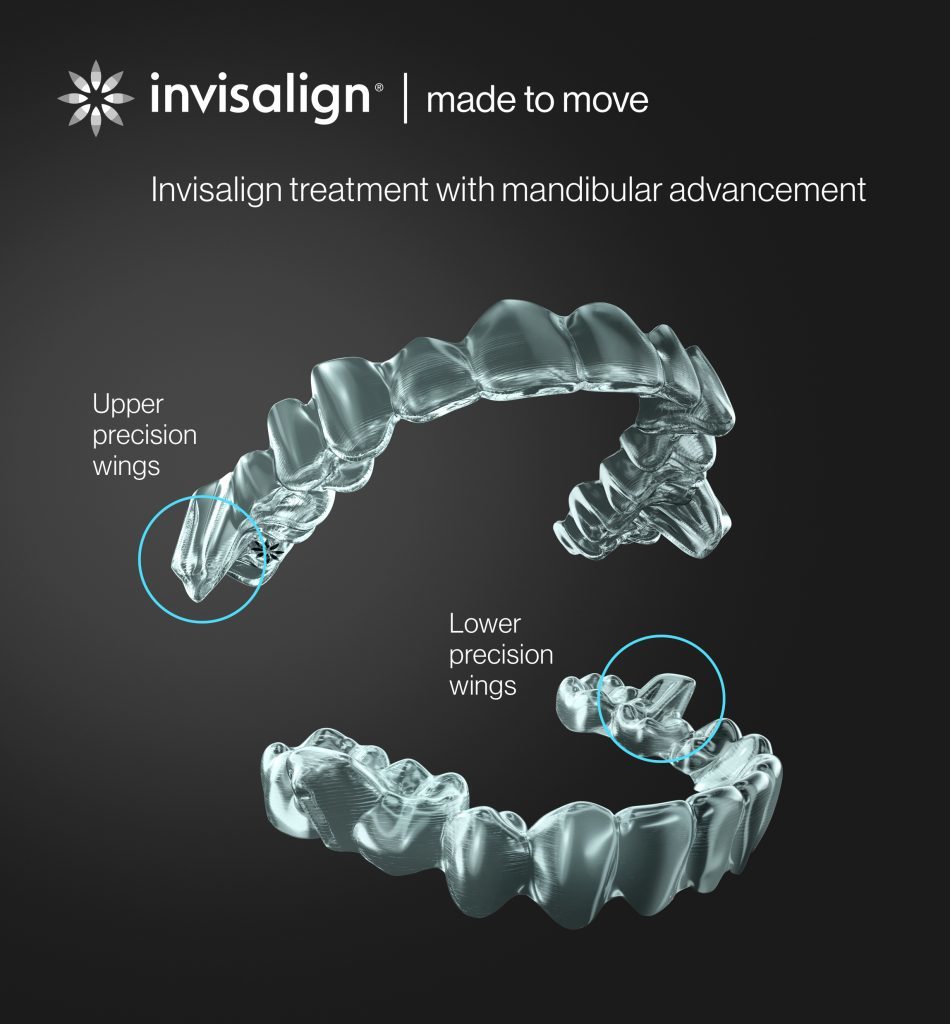 Invisalign Teen With Mandibular Advancement Launched - Dentistry.co.uk