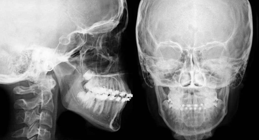New regulations on Xray use Dentistry.co.uk