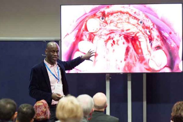 The Implant Dentistry Show is coming to London this February