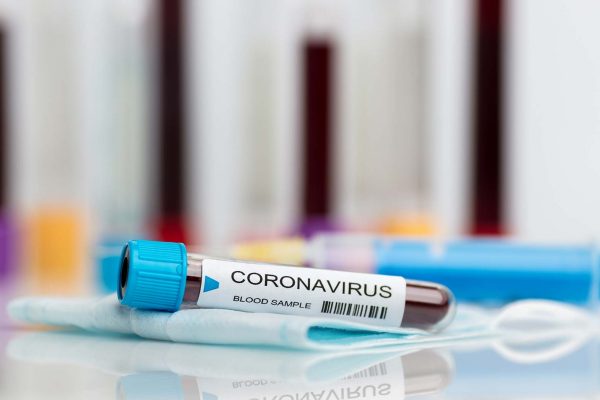 Blood sample during COVID-19