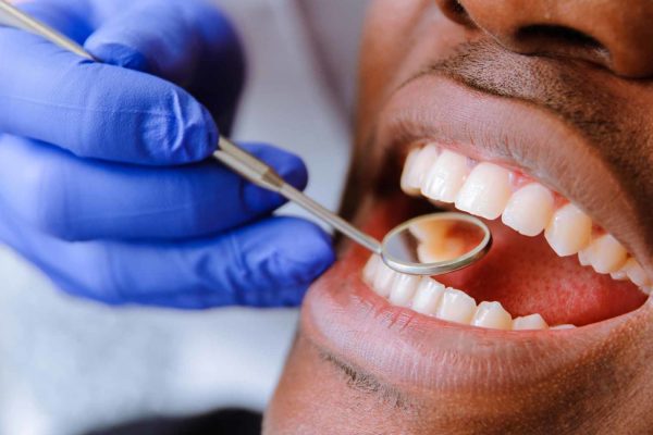 Fewer patients are receiving treatment from NHS dental practices, according to newly-released statistics