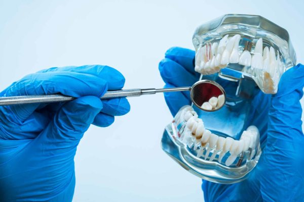 Members of the British Dental Association (BDA) have launched legal action against the association following a data breach