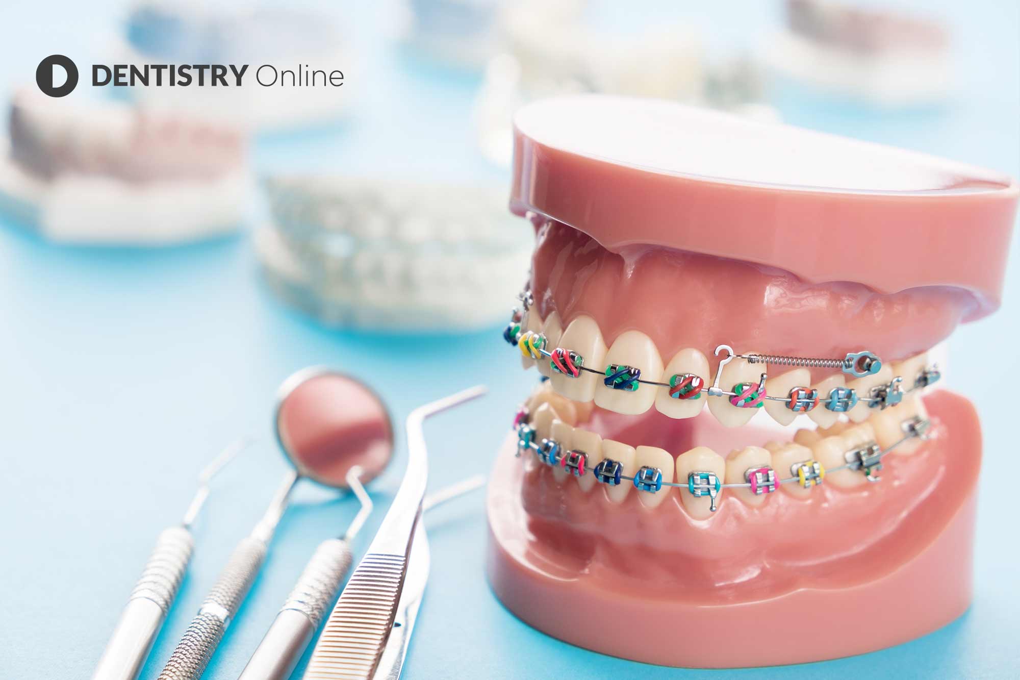 Orthodontic Marketing