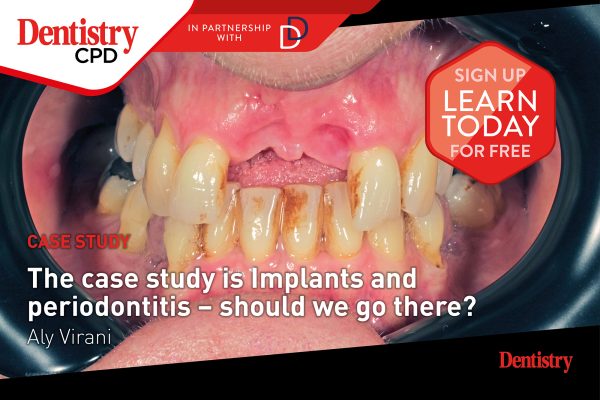 Dentistry CPD: new this week – implants and periodontitis – should we go there?
