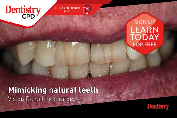 Dentistry CPD: new this week – mimicking natural teeth