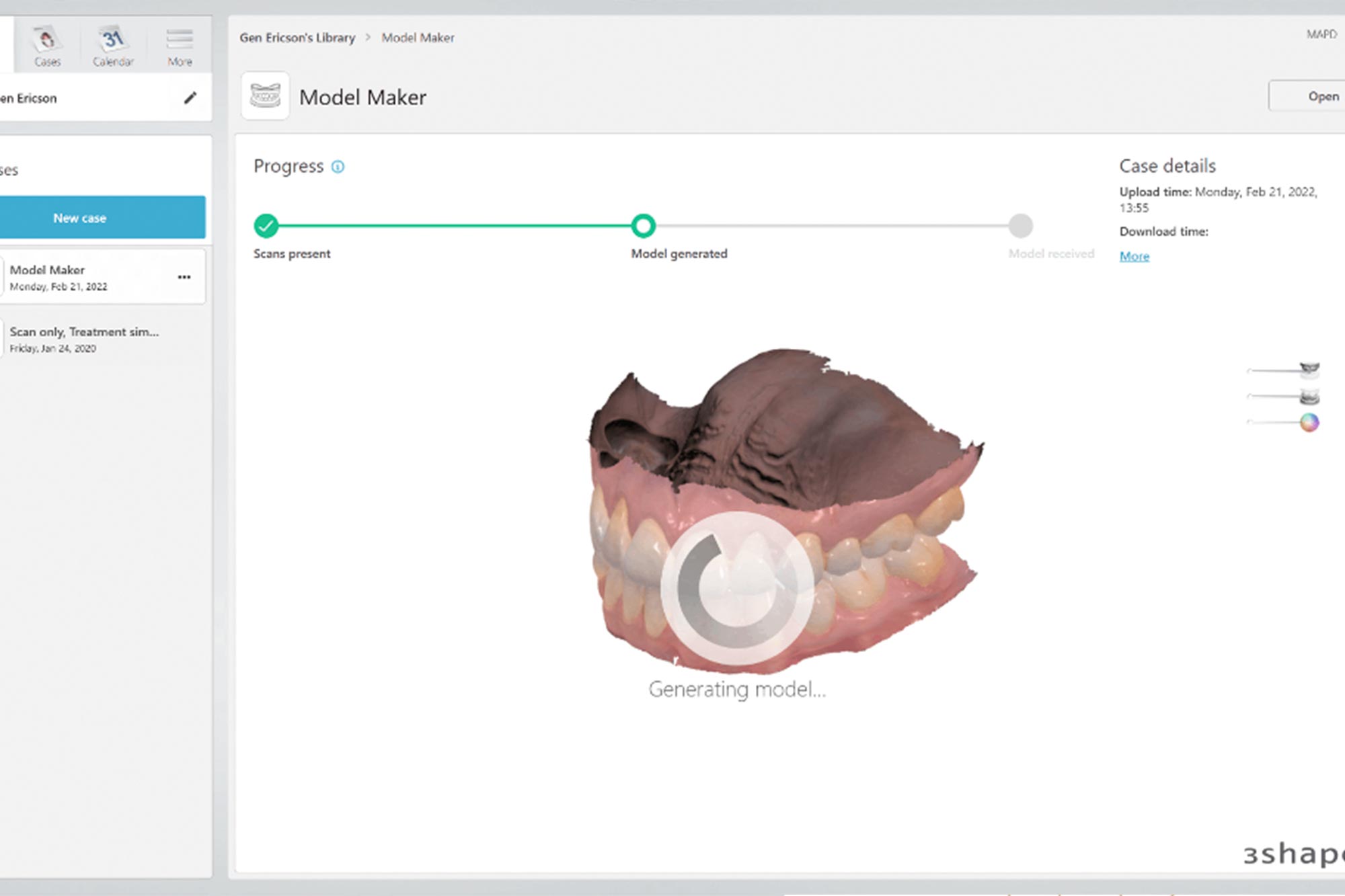 3shape Model 3shape Model Maker: create dental models in minutes! - Dentistry
