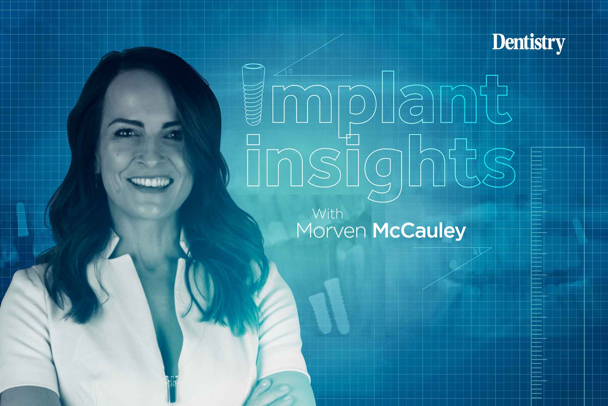 Implant Insights - Morven McCauley explains the best methods of implant record taking