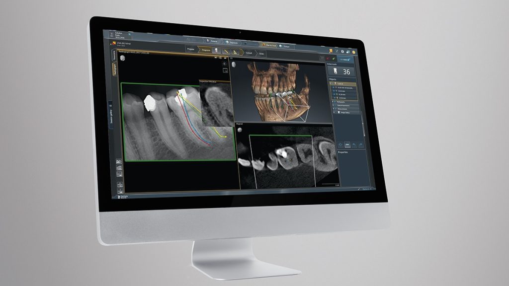 Function and aesthetics with CBCT - Dentistry