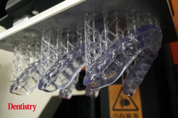 Andre Gaul RDT gives a step-by-step overview of the design and fabrication process of printed occlusal splints.