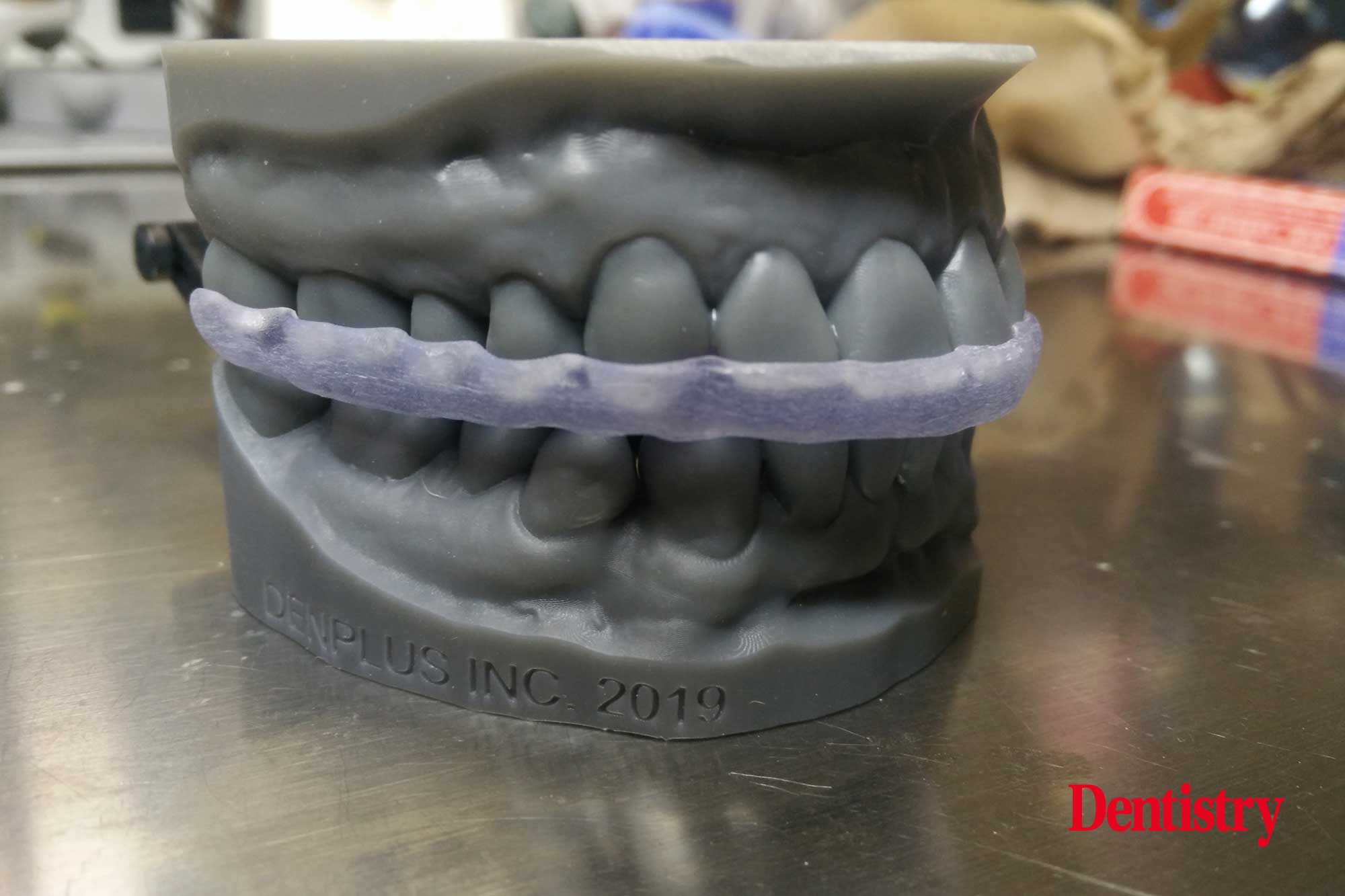 Andre Gaul RDT gives a step-by-step overview of the design and fabrication process of printed occlusal splints.