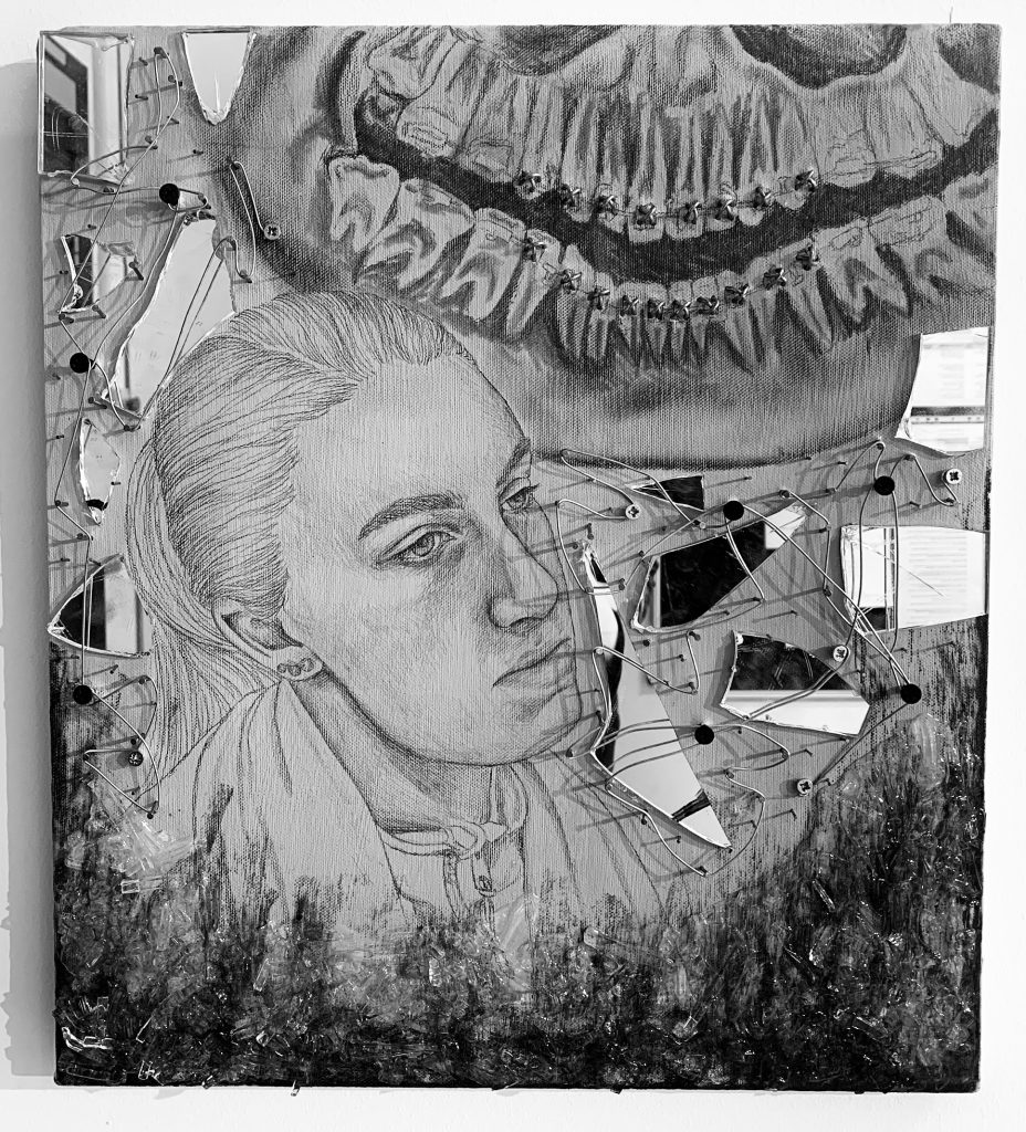 My jaw surgery experience through art Dentistry