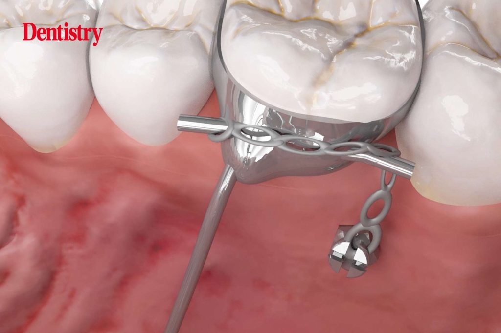 My top four orthodontic musthaves Dentistry