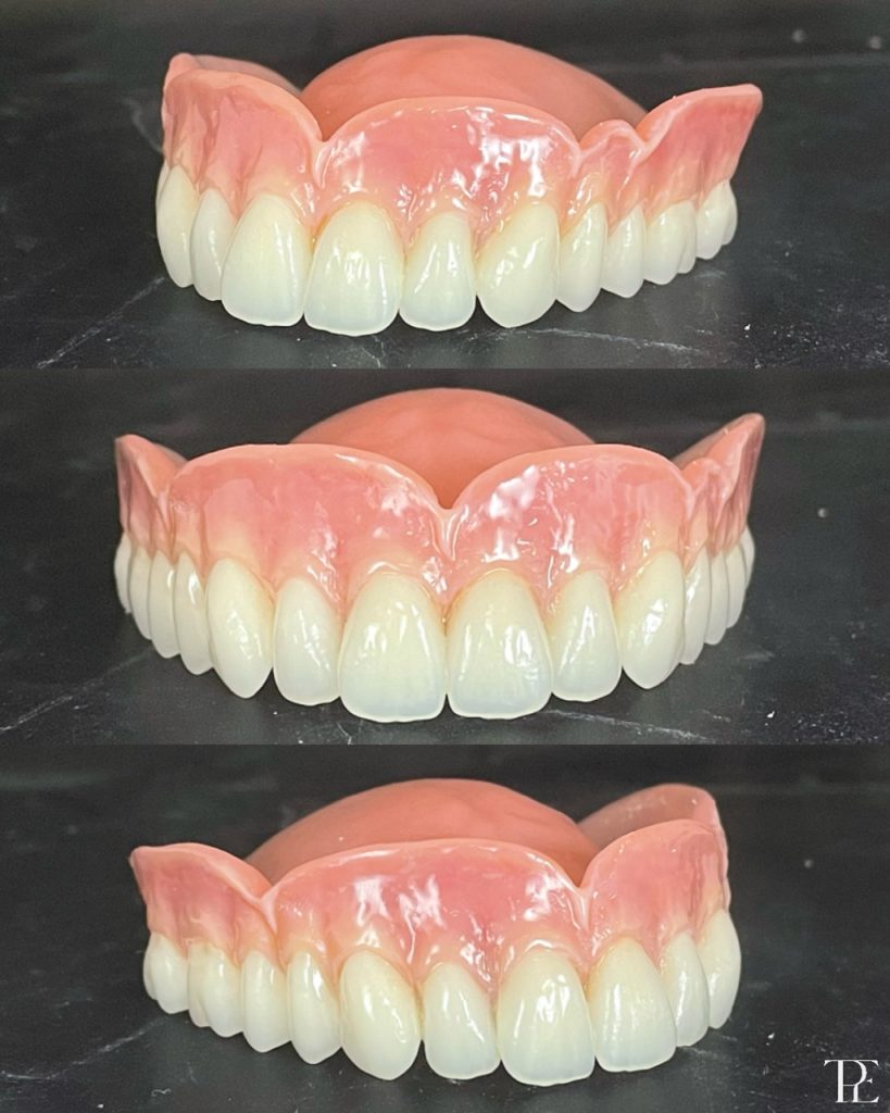 Finding my feet as a dental technician Dentistry