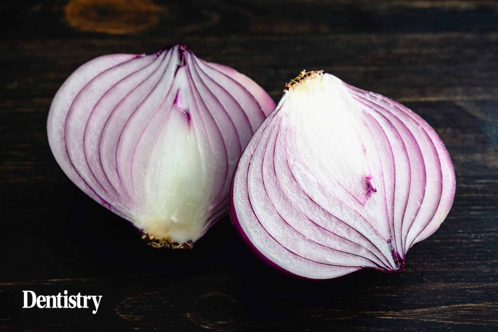 Connecting with your team peel back the onion Dentistry