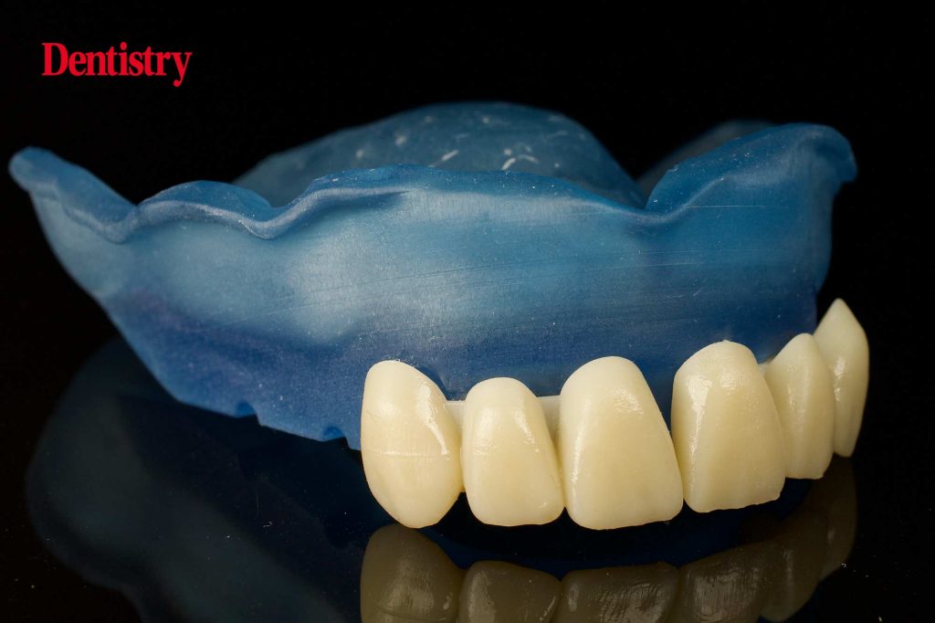 Auxiliary digital parts 3D printing and its possibilities Dentistry