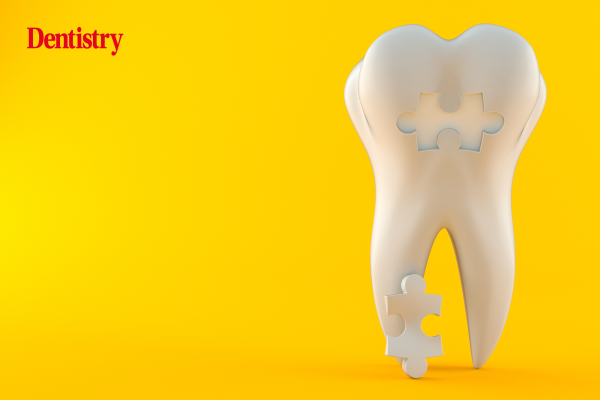 image representing the puzzle of indirect or direct restorations