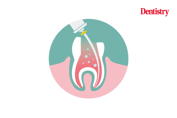 Paul Lambden discusses the legal risks of endodontics and root treatment