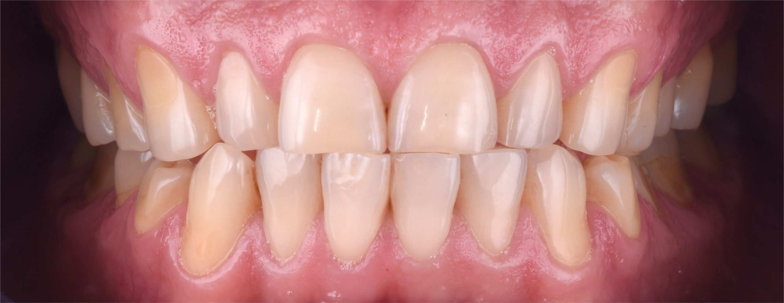 Figure 2_ Initial intraoral documentation_1 - Dentistry.co.uk