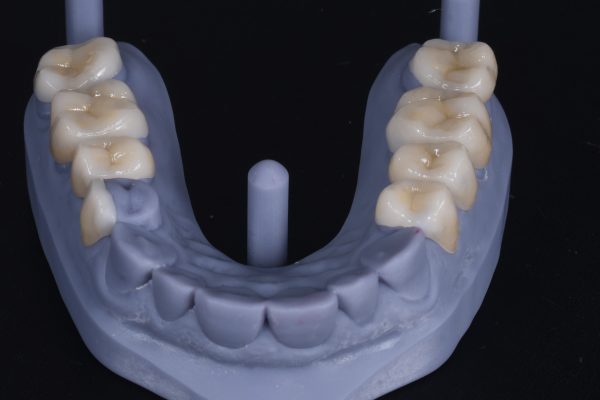 Figure 5. VDO Augmentation
