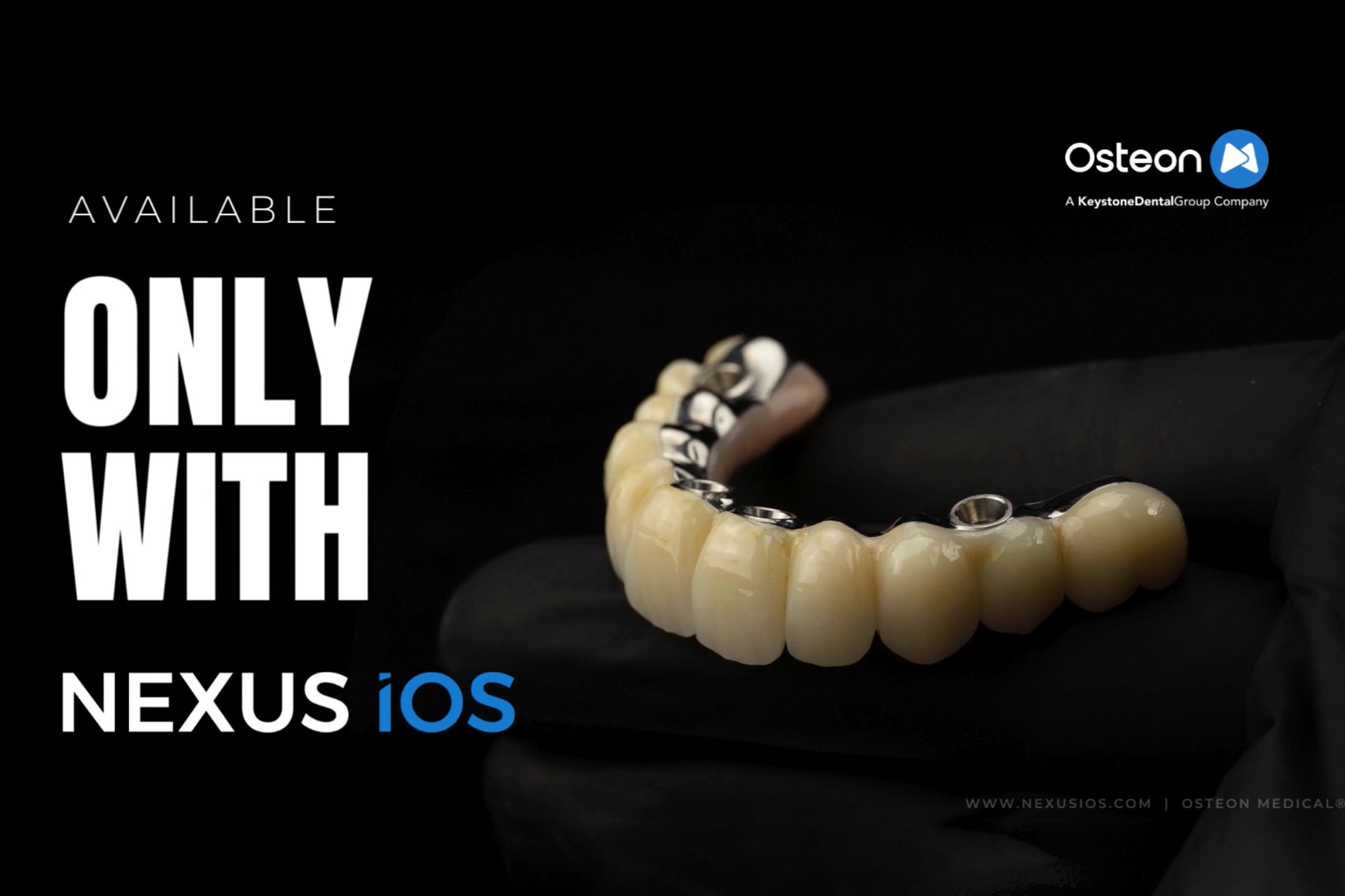 Nexus iOS - Digital Full-Arch Technology – Keystone Dental Group