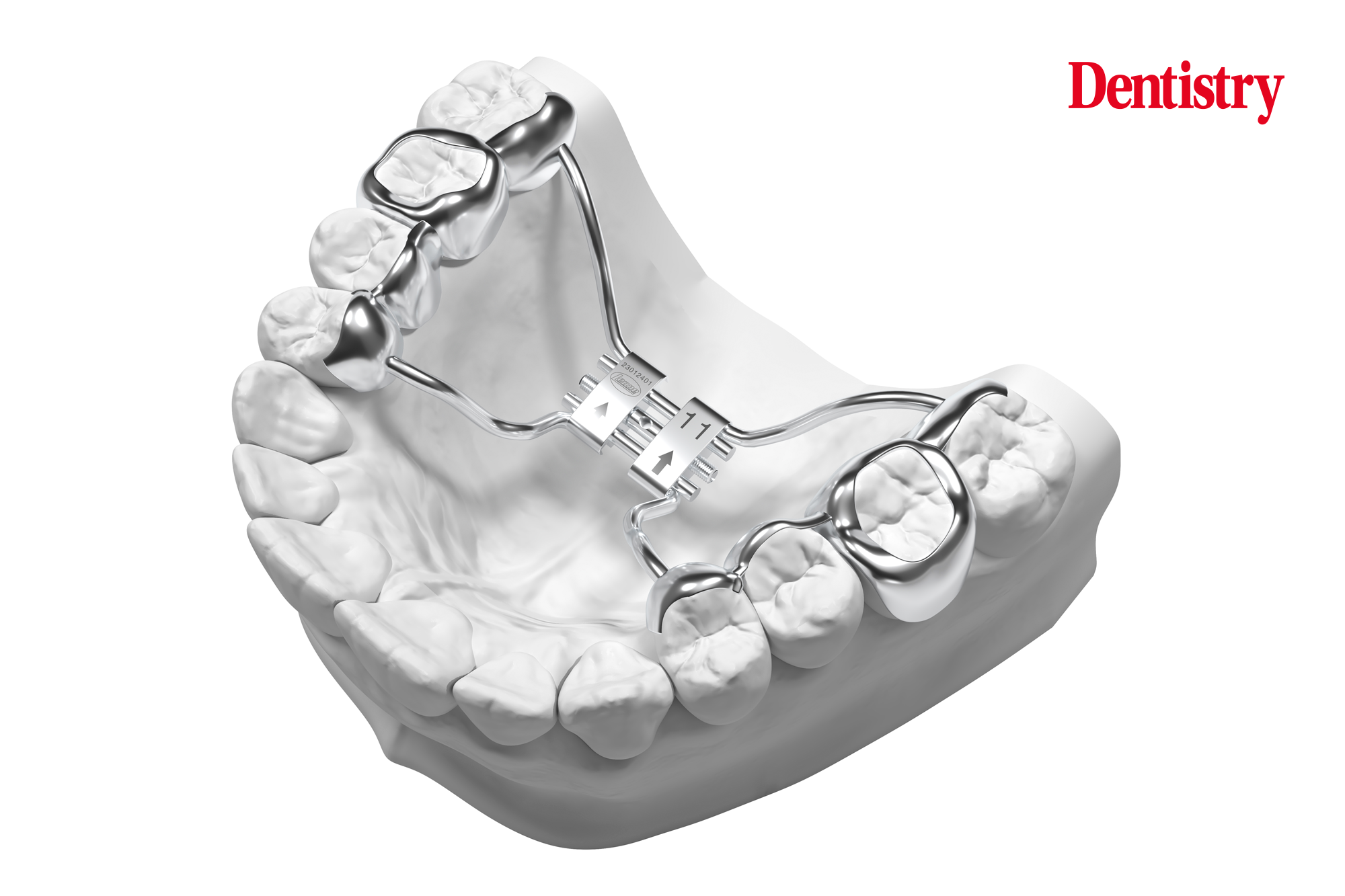 3d printed palatal expanders