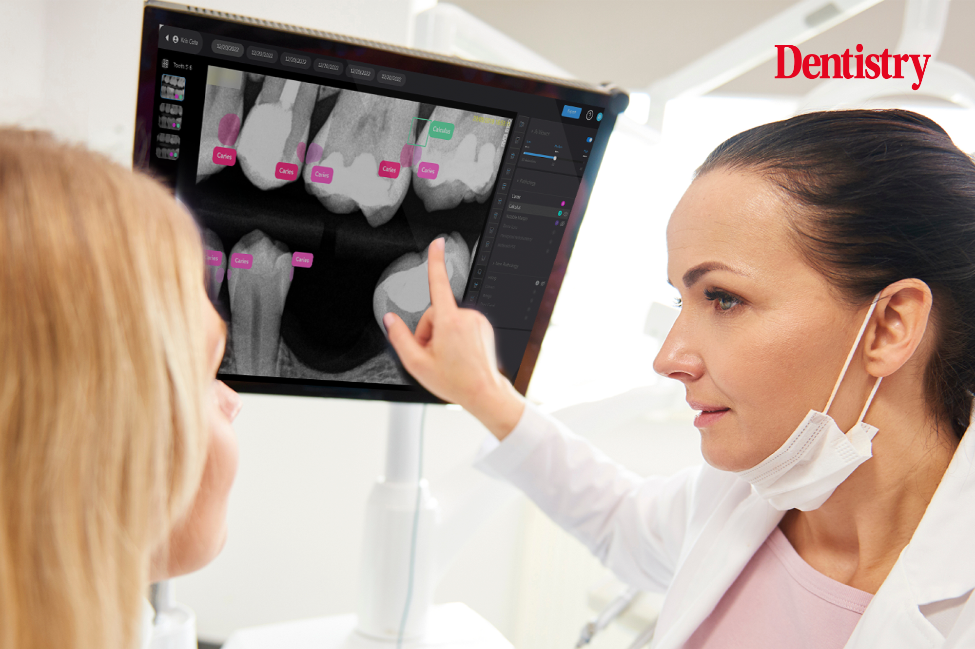 AI in dental imaging