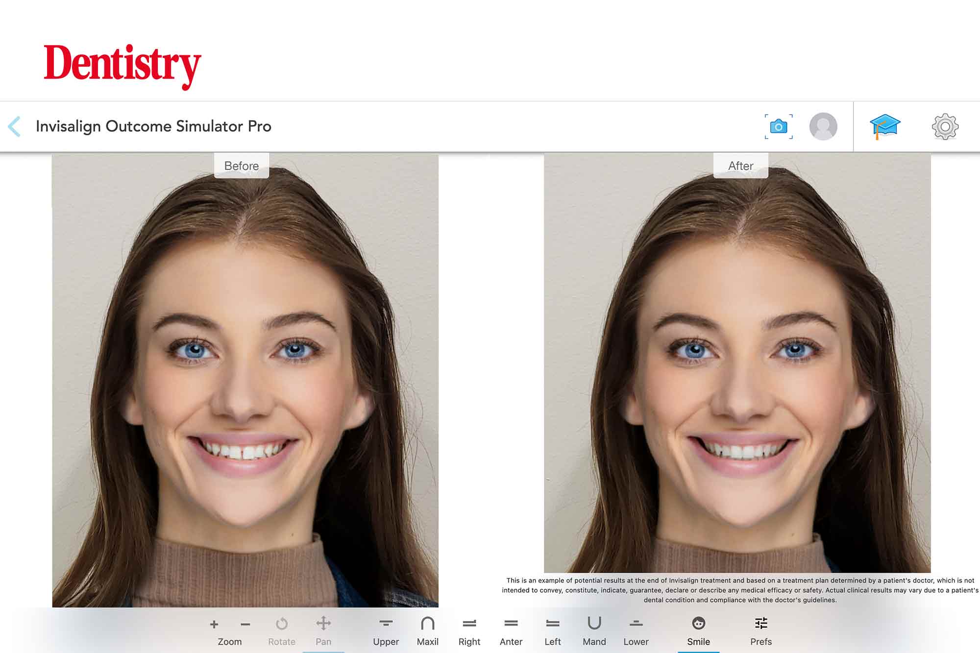 Intraoral scanners take the leap into digital in 2024 Dentistry