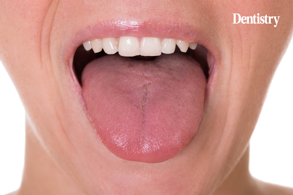 
'Artificial tongue' developed to target oral bacteria 
