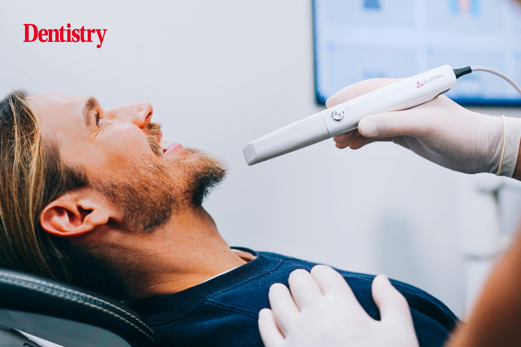 New intraoral scanner balances cost and performance