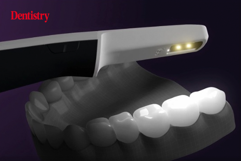How the iTero Lumina intraoral scanner transforms clinical outcomes