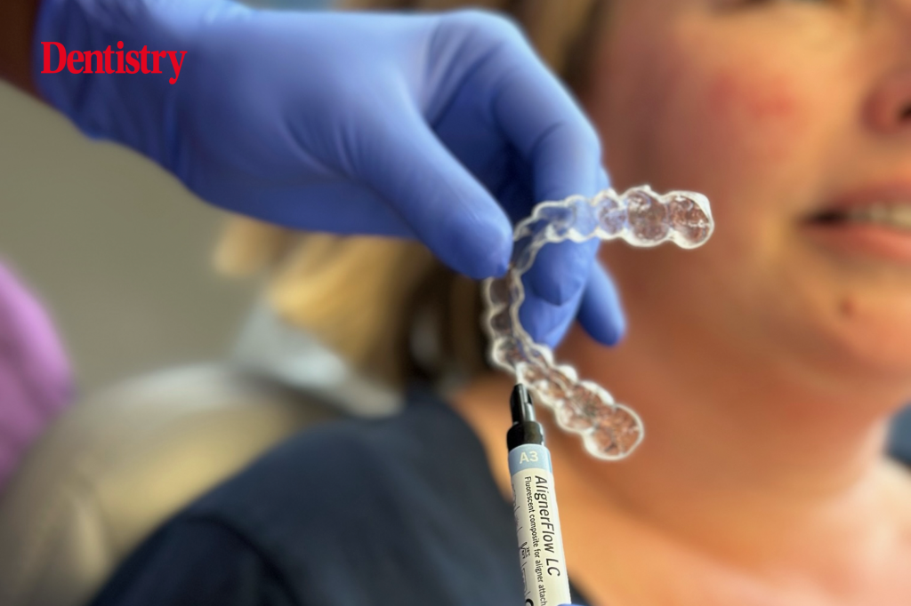 A game-changer for clear aligner therapy success