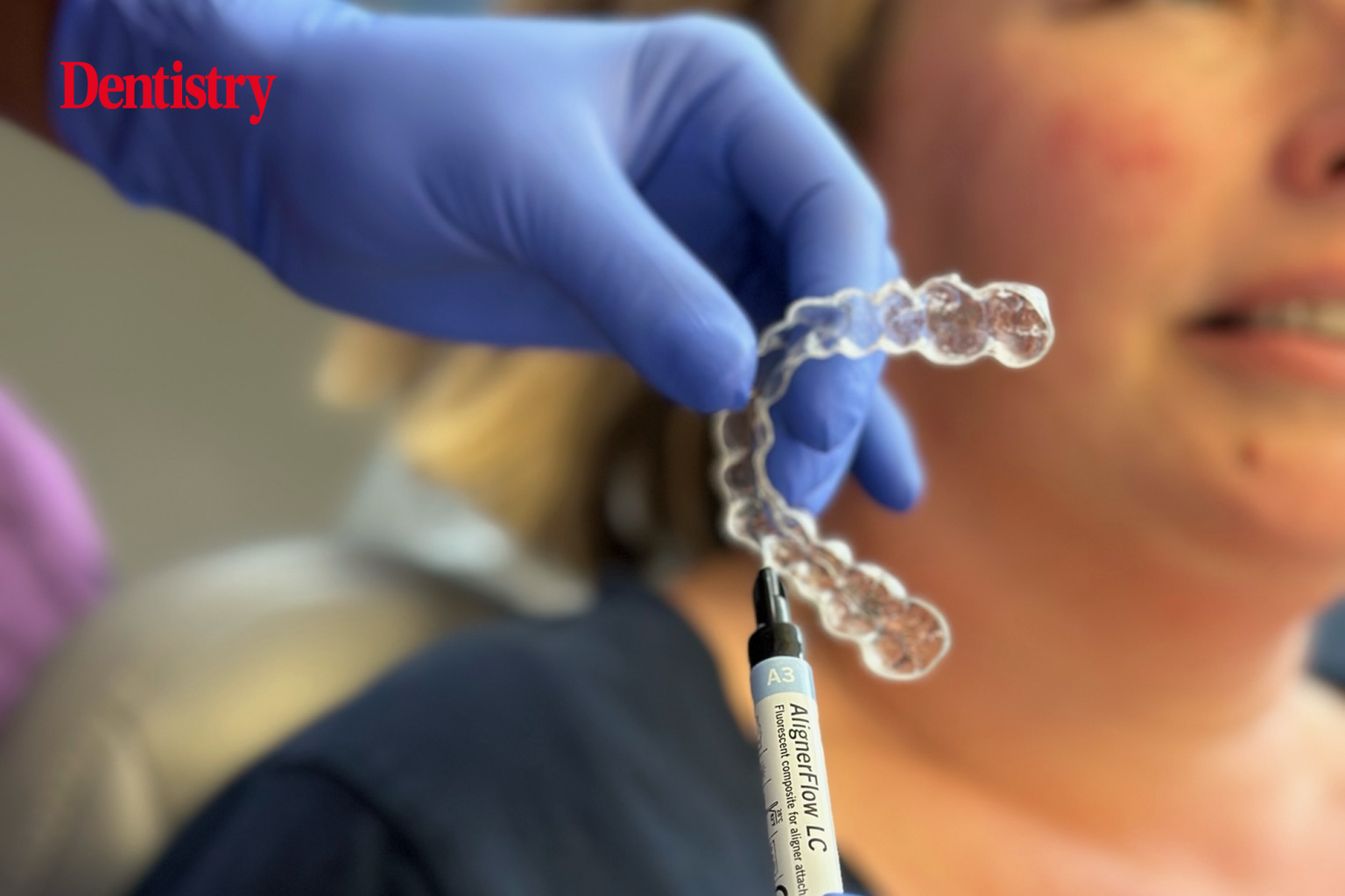 A game-changer for clear aligner therapy success - Dentistry