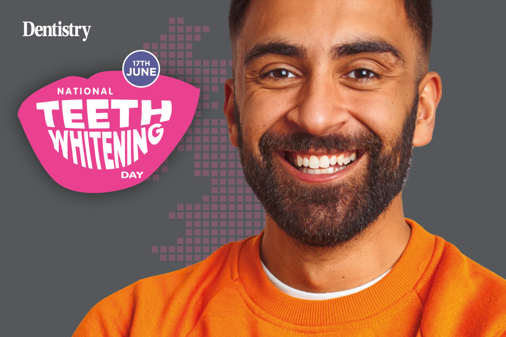 Case study: enhancing smiles with tooth whitening - Dentistry