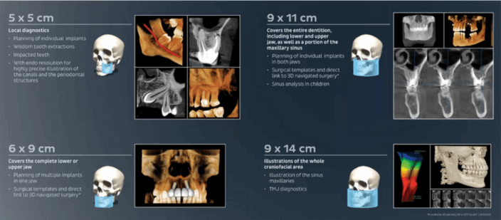 Dexis OP 3D Vision CBCT scanners use Tx STUDIO software