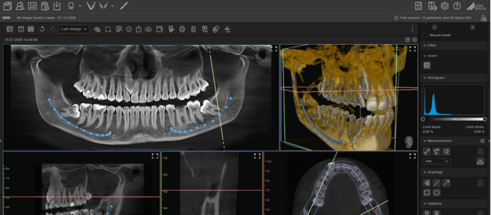 A scan made using Dürr Dental's VistaVox S CBCT scanner