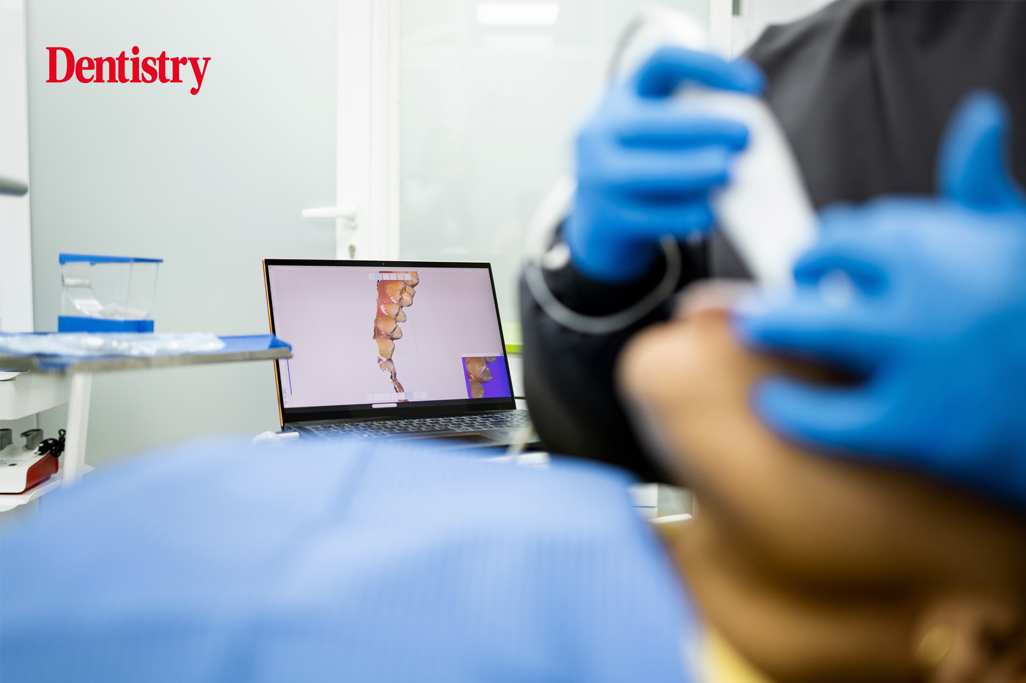 Why a CPO scanner might be the best fit for you