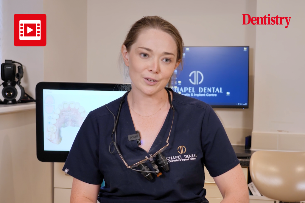 WHAT ARE COMPOSITES IN DENTISTRY visual data 7