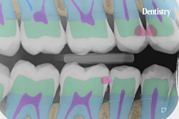 'Remarkable accuracy': how AI has changed my practice