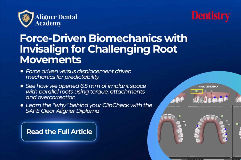 Force-driven Invisalign biomechanics for challenging root movements