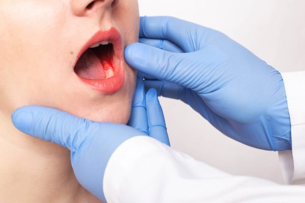 With smoking and disposable vape bans due to take effect, here's what dental professionals need to know about smoking, vaping and oral health.