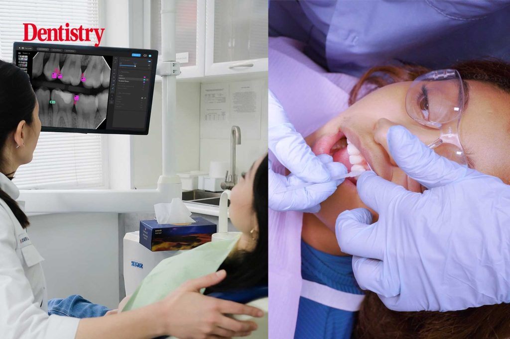 Proactive treatment of tooth decay from Pearl and vVARDIS