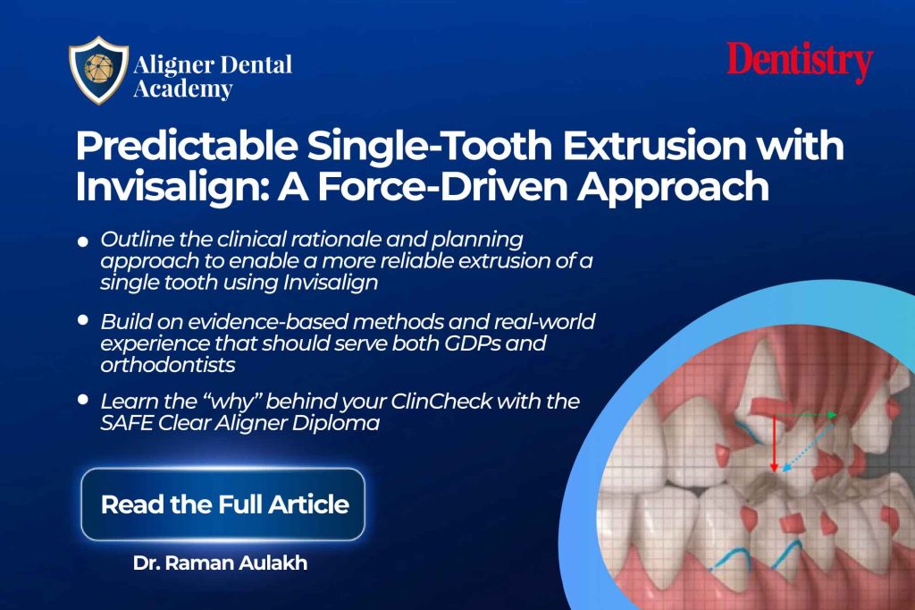 Predictable single-tooth extrusion with Invisalign: a force-driven approach