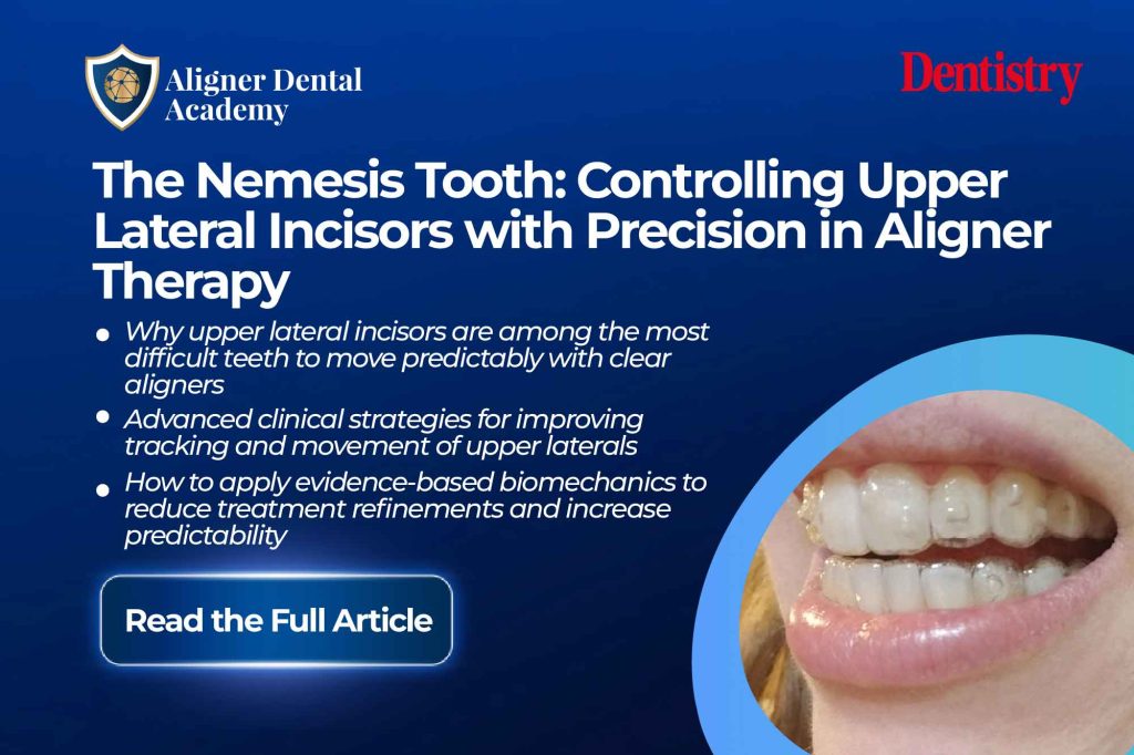 The nemesis tooth: controlling upper lateral incisors with aligners