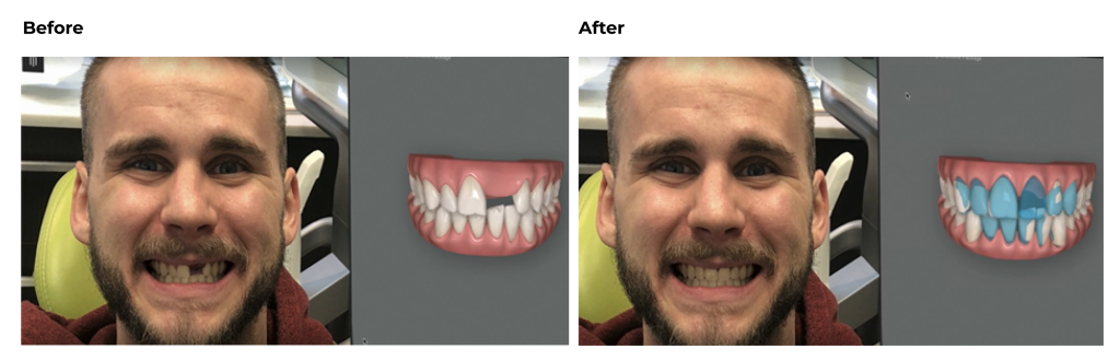 Ortho meets restorative: the ultimate power duo