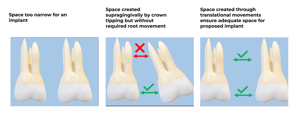 Ortho meets restorative: the ultimate power duo
