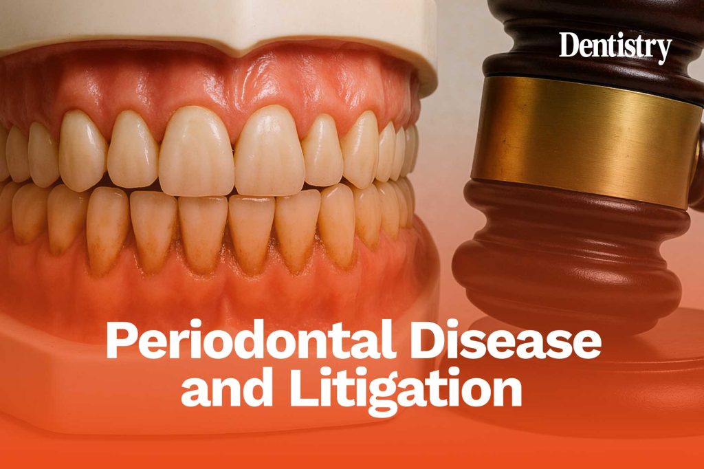 Periodontal disease and litigation:&nbsp;what really causes gum disease? 
