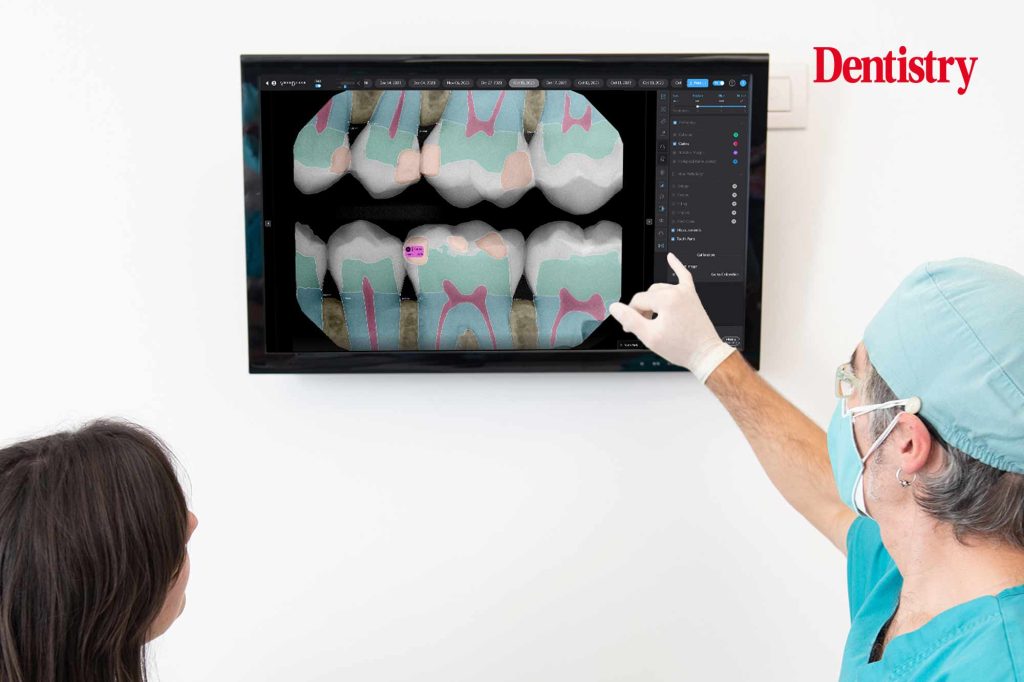 How AI has helped me to utilise the whole dental team